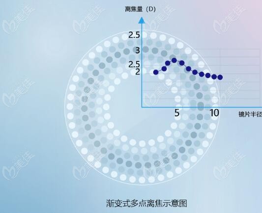儿童离焦镜价格