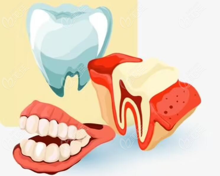 想给牙齿做治疗的看过来www.236z.com 想给牙齿做治疗的看过来www.236z.com