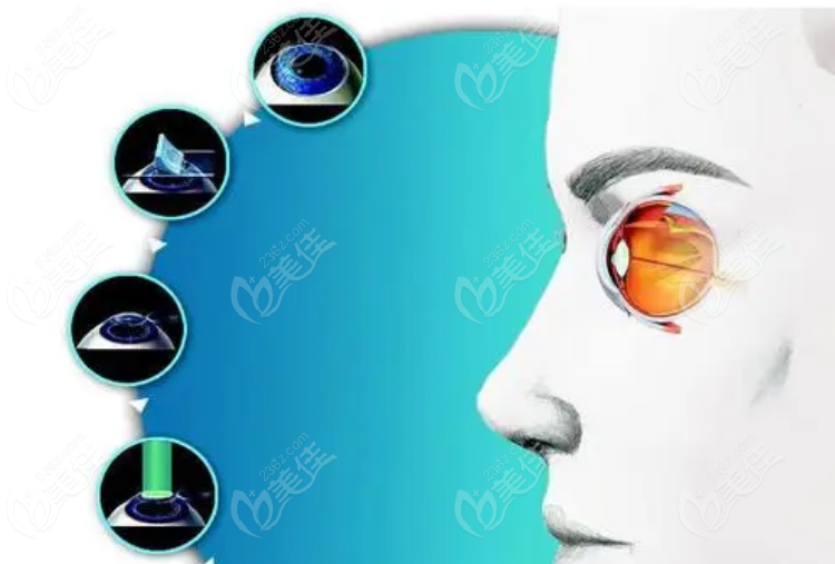青岛比较好的眼科医院 青岛比较好的眼科医院