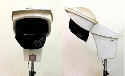 雾化控油疗法治疗脱发