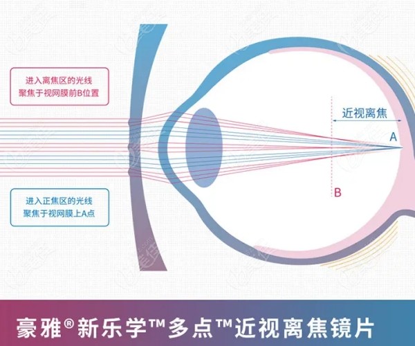 青少年近视防控镜片哪个牌子好新乐学