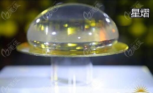 傲诺拉星熠假体怎么样