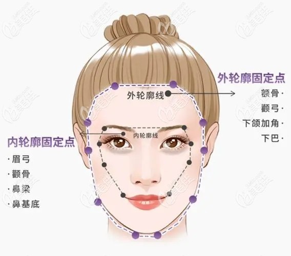 易朝华是南京打玻尿酸审美好看的医生