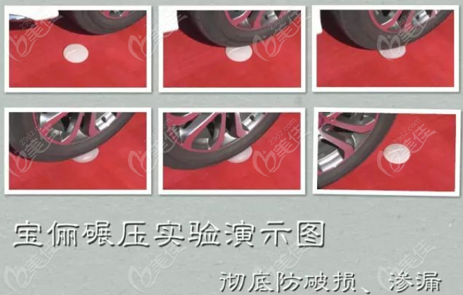 法芮娅假体质量好