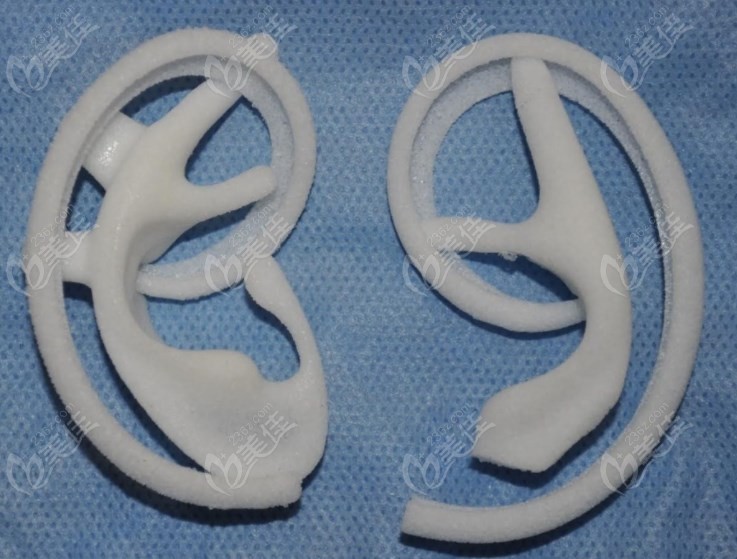medpor支架一次性造耳費(fèi)用美佳網(wǎng)