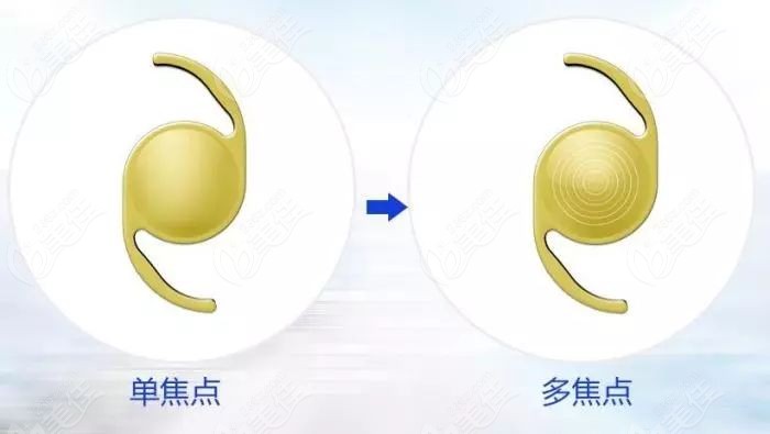 单焦点和多焦点晶体的区别www.236z.com