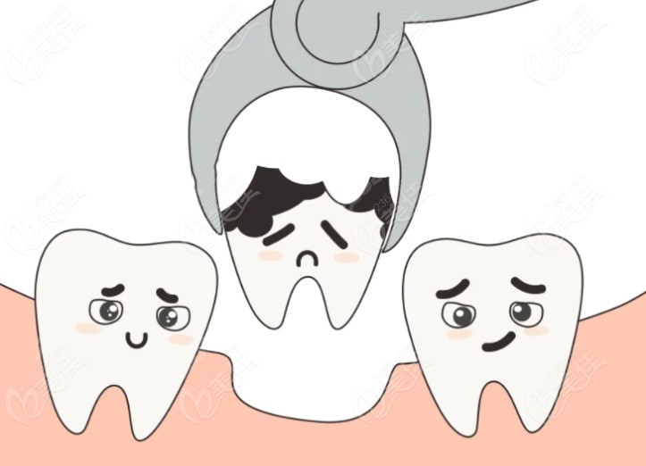 烂牙根长期不拔的危害和后果
