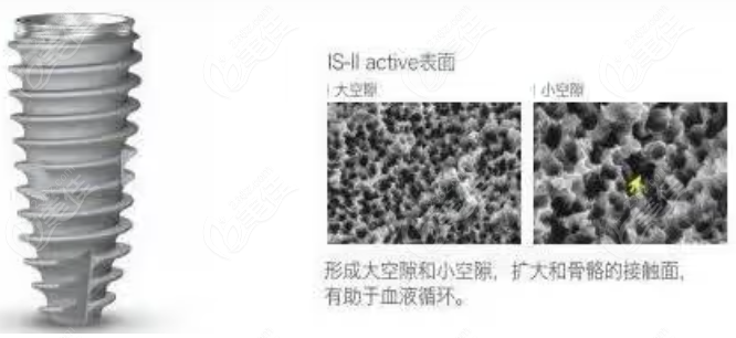 纽百特种植体表面处理236z.com