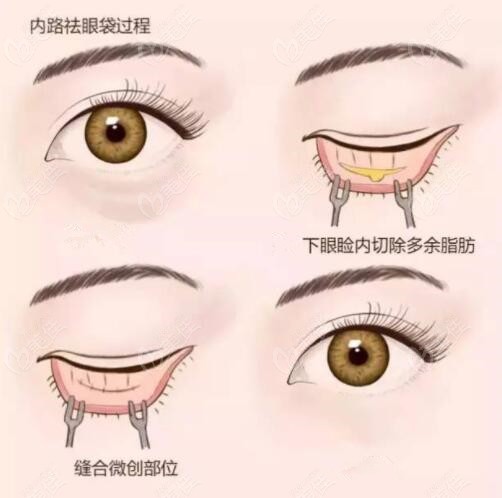 如何找到王贵雄m.236z.com