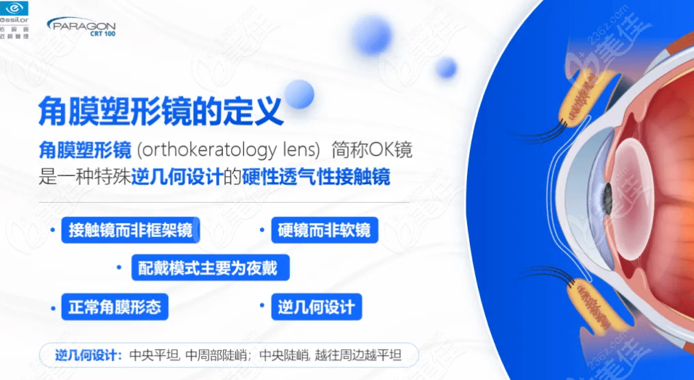美国CRT角膜塑形镜怎么样