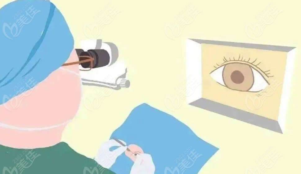 医生做眼科手术 医生做眼科手术