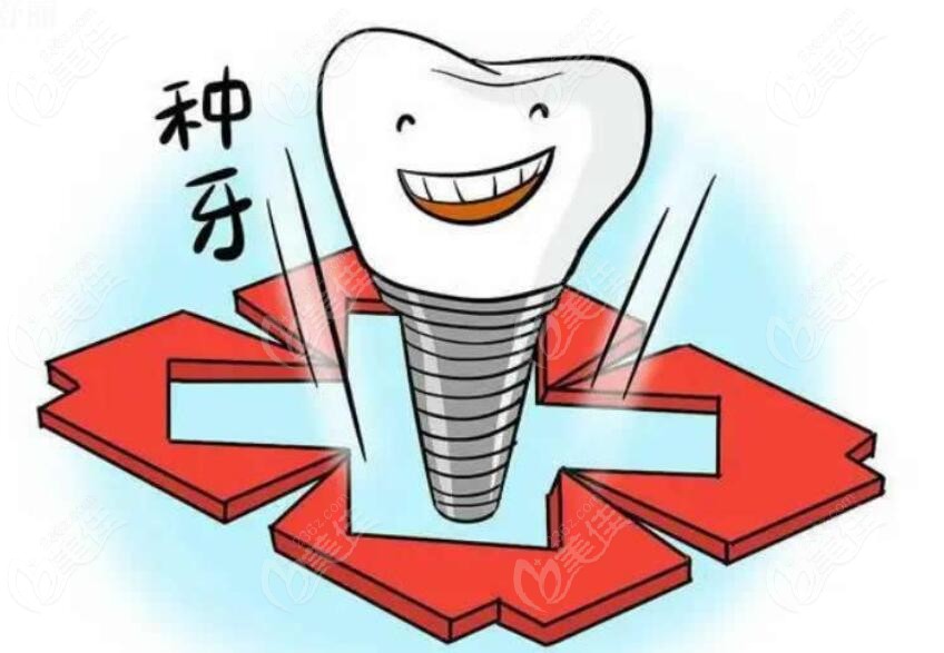 成都牙齿种植价格