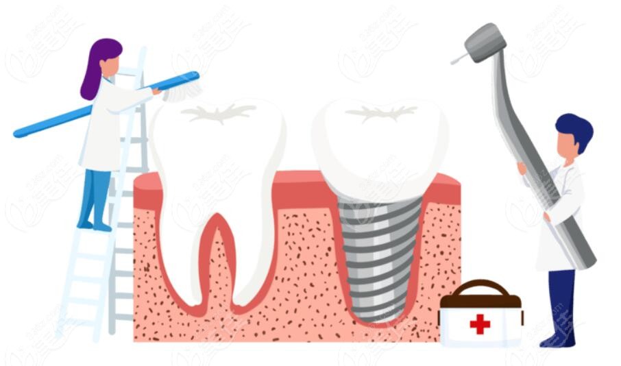 想知道种植牙价格的看过来236z.com