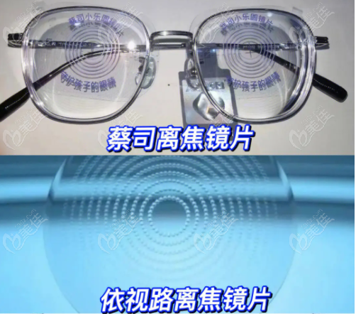 离焦框架镜价格1380元起