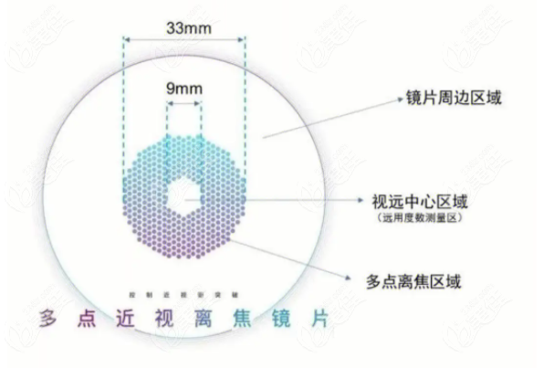 离焦框架镜的优势
