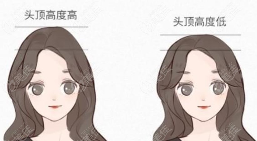 10支玻尿酸打高颅顶前后对比照片m.236z.com 