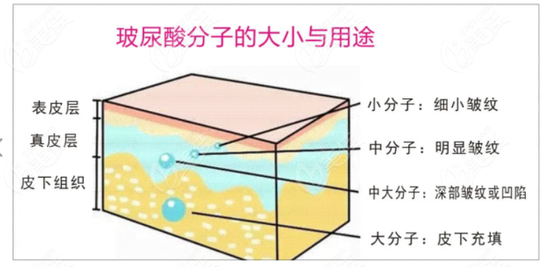 <!--<i data=20240703-sp></i>-->艺星微整形医生张洋洋怎么样