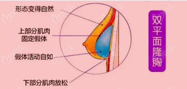 张让虎隆胸实例不少236z.com