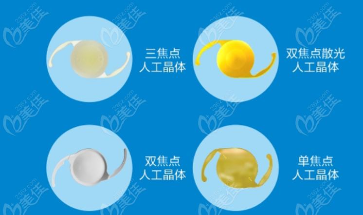 白内障人工晶体种类和类型