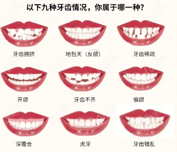 昆明正规靠谱的私立牙齿矫正医院排名@美佳网
