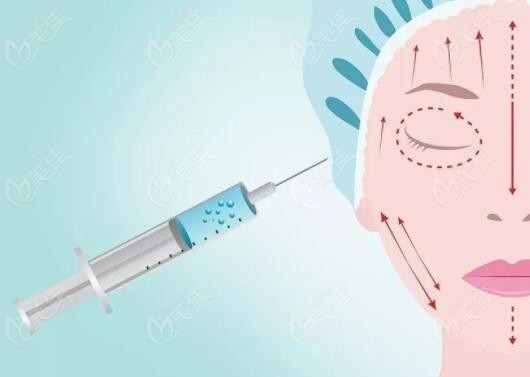 打胶原蛋白7天后回落正常吗m.236z.com