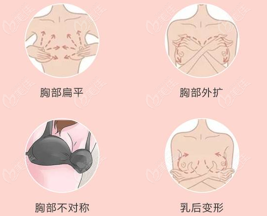 武汉艺星医疗美容隆胸好