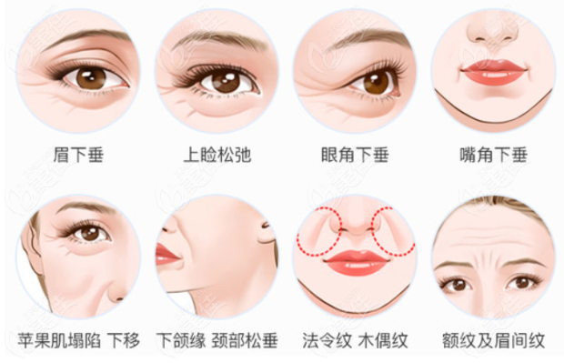 <i data-id='d52adc24-8968-4df3-97be-560ff9a860d4' style='display:none;'></i>医院王小彦医生拉皮技术怎么样