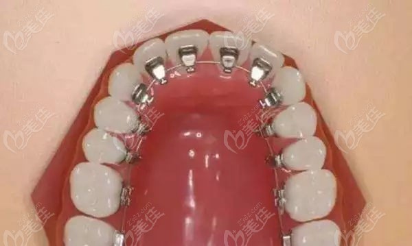 秦龙正畸医生在哪家医院看诊