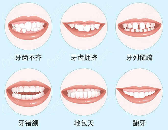 秦龙医生做牙齿矫正怎么样236z.com