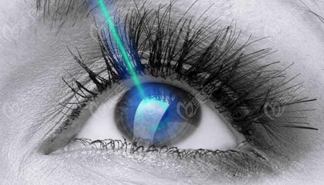 哺乳期的女性想做近视眼激光手术等身体恢复再做（www.236z.com）