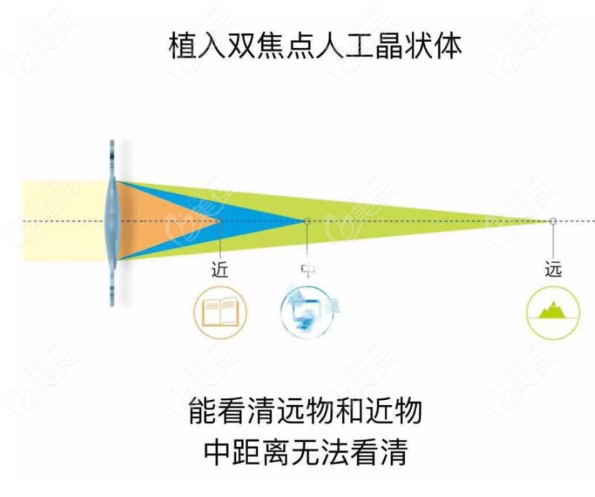 三焦晶体比双焦晶体视觉质量好