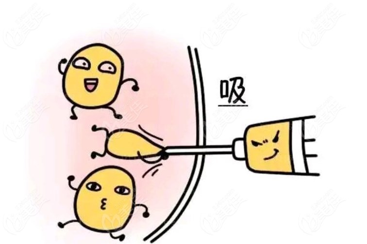 北京腰腹吸脂医院医生价格m.236z.com