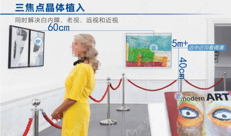 爱尔康三焦点人工晶体怎么样