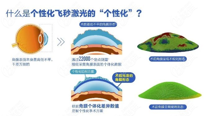 个性化飞秒和普通飞秒的区别23/6z.com 