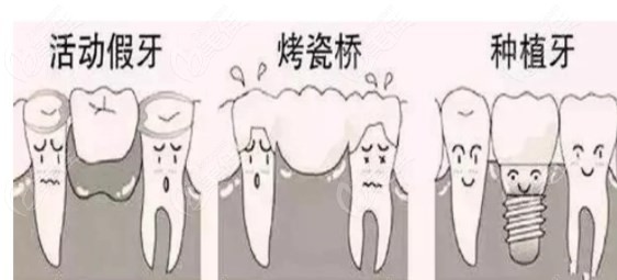 牙没了的三种修复方式
