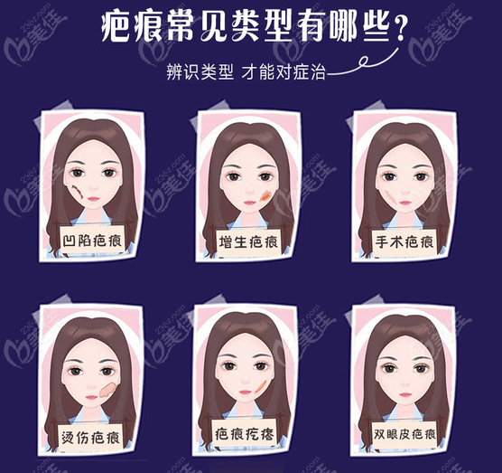 成都淡化疤痕好的医院有哪些