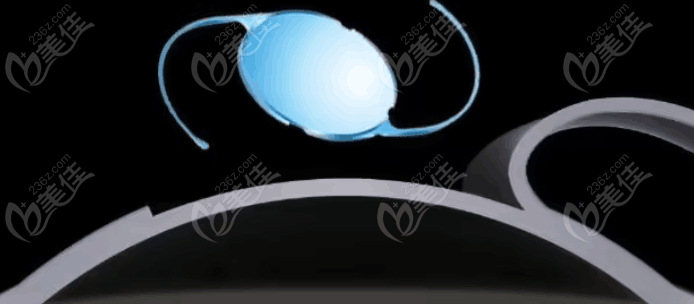 三焦點晶體適應(yīng)護理指南（236z.com）