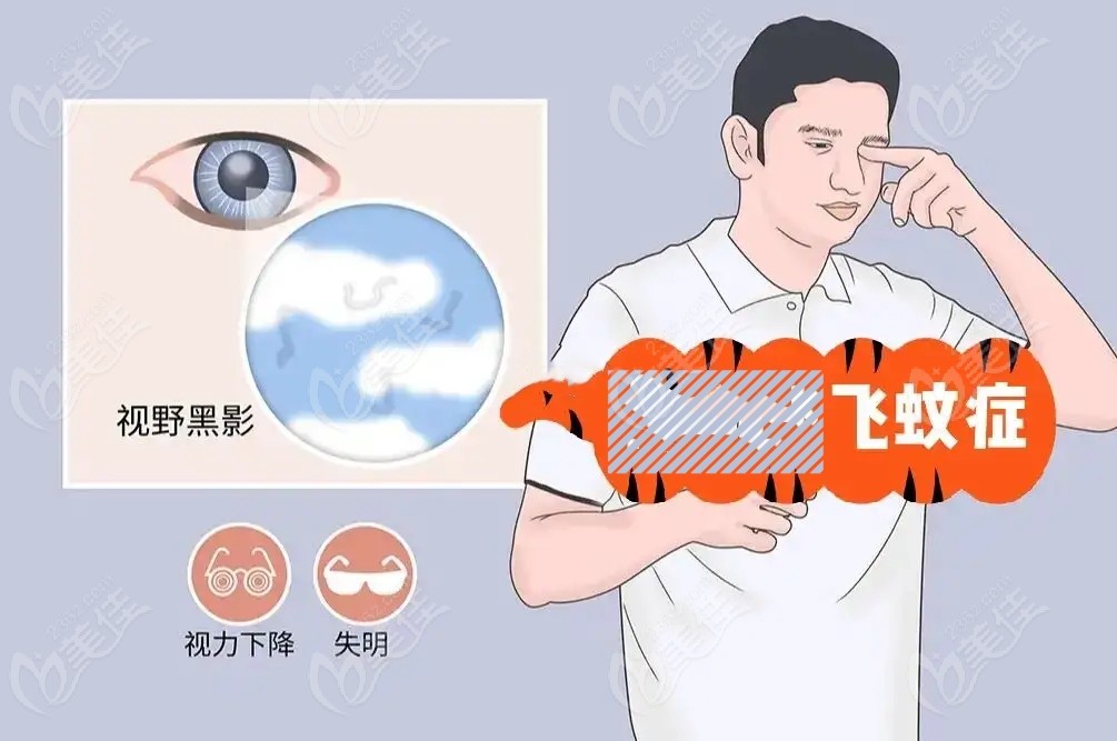 公布北京治疗飞蚊症比好的眼科医院排名