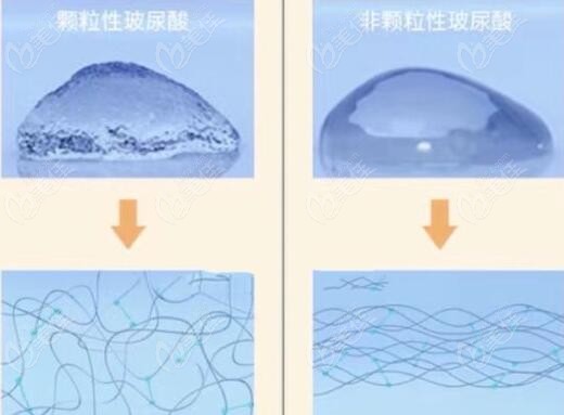 海魅玻尿酸和海薇玻尿酸的区别
