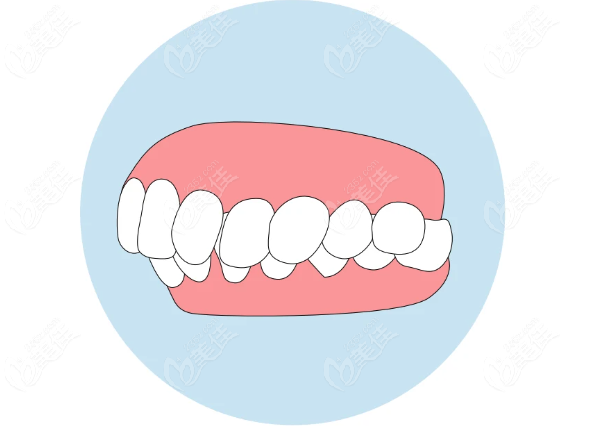 上海深覆合矯正醫院排名前十www.236z.com