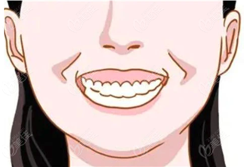 上海深覆合矯正醫院哪個好