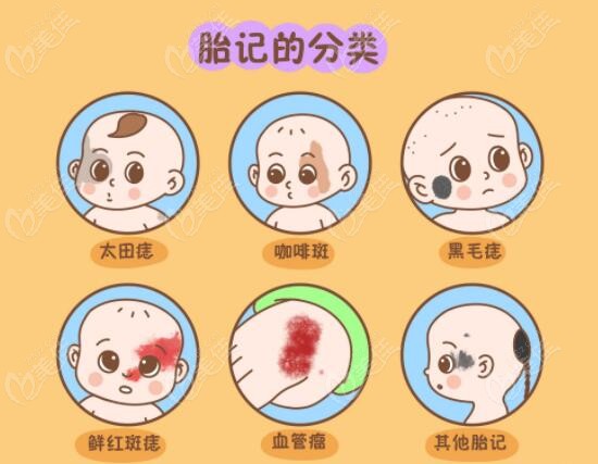 胎记分类及其影响