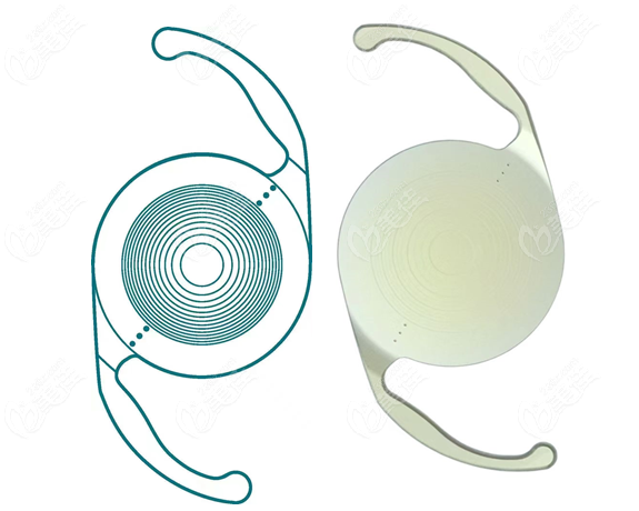 眼力健人工晶体适合18岁-50岁以上年龄的人群