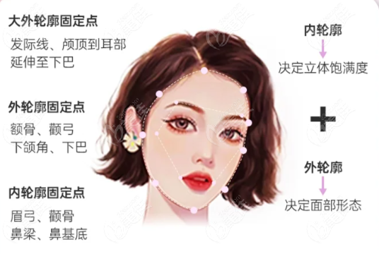 芭比針和少女針注射部位圖片