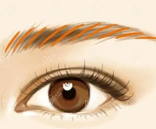 沈陽北方整形醫(yī)院做雙眼皮怎么樣 沈陽北方整形醫(yī)院做雙眼皮怎么樣