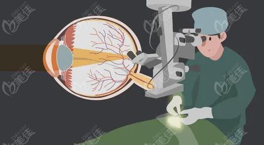 成都新视界眼科医院近视手术技术优势