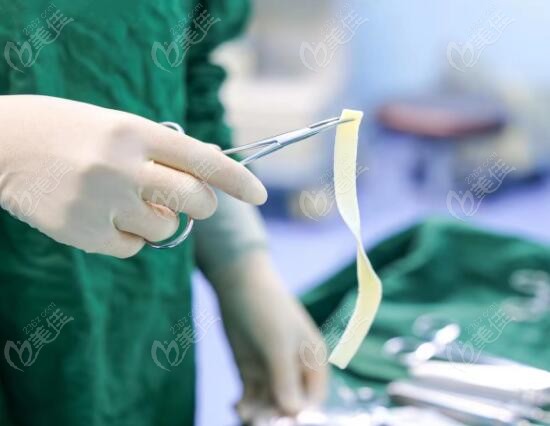 3D生物束带3个月能拆吗m.236z.com