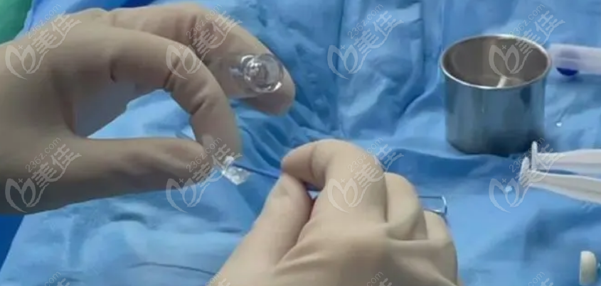 晶体植入近视手术能维持多少年