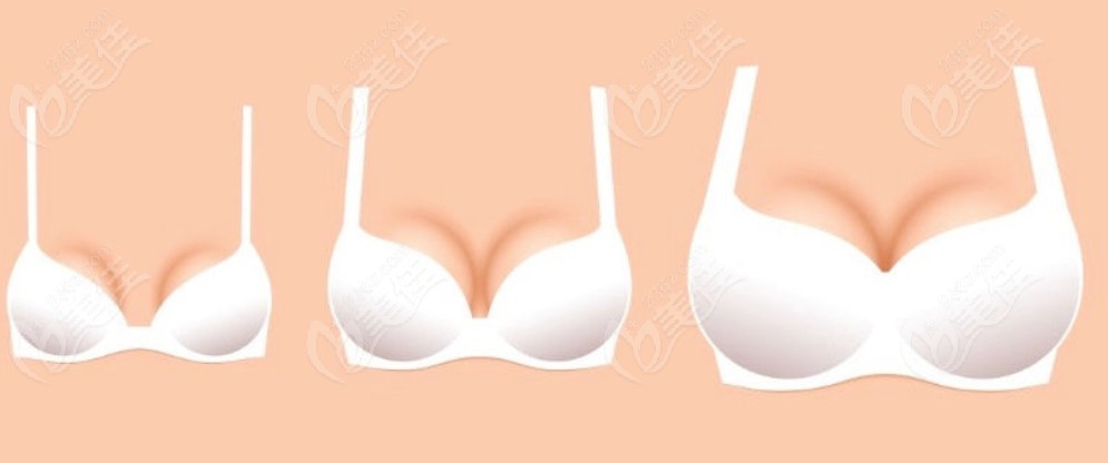 北京英煌做脂肪豐胸前后對比圖 北京英煌做脂肪豐胸前后對比圖