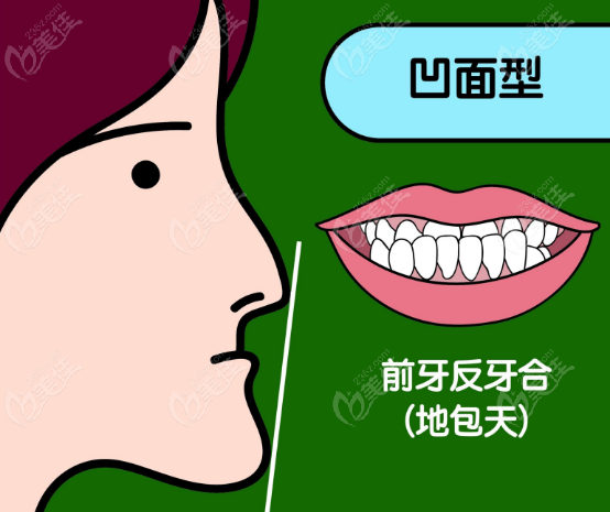 何锦泉和<!--<i data=20240703-sp></i>-->谁做地包天更好www.23、6z.com